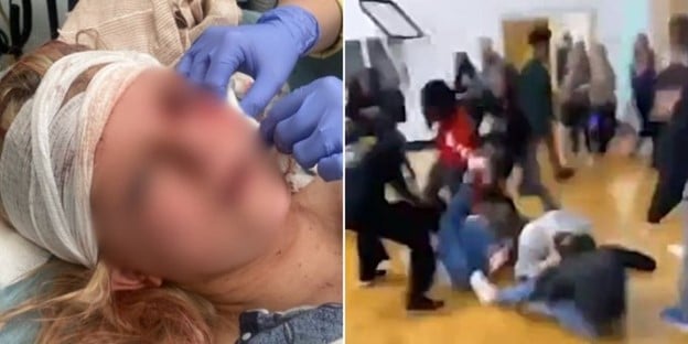 HORROR: Helpless Georgia Girl Stabbed Multiple Times at School, Leaving Her with Life-Altering Injuries – Lawsuit Alleges School Did NOTHING to Protect The Victim and Violated District Policy (VIDEO)