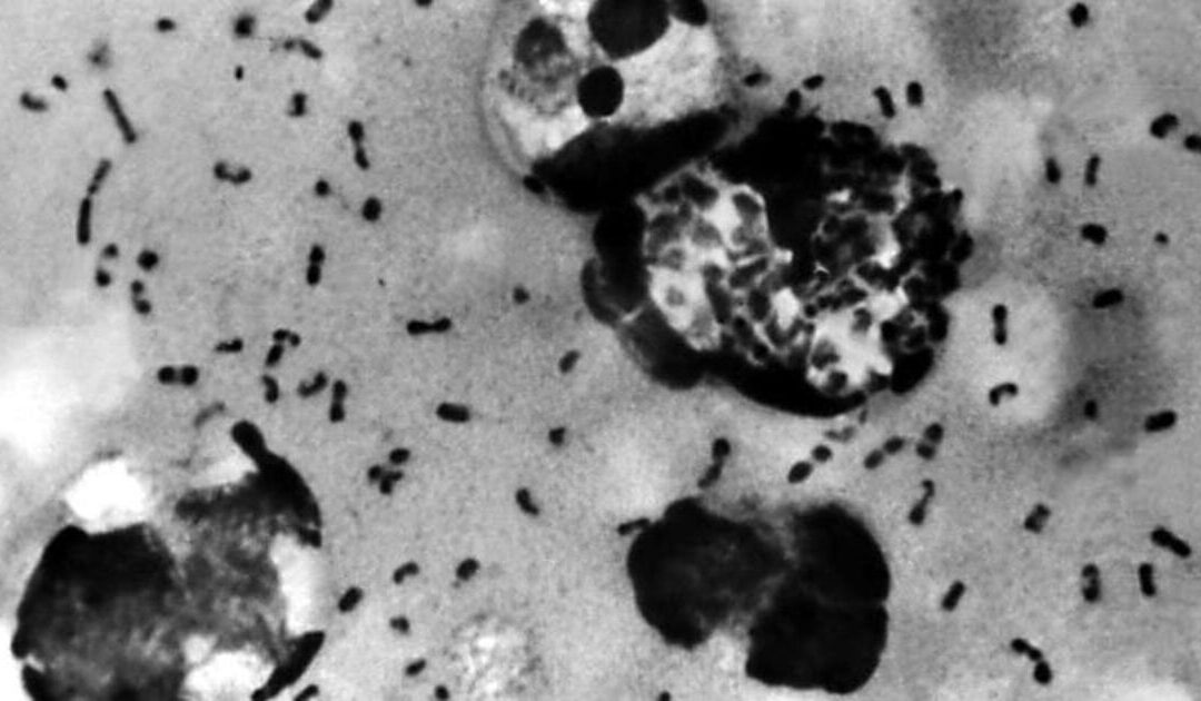 Public Health Officials Warn of Human Plague Case in Colorado