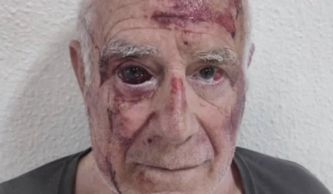 Violent Riots Explode in Spanish Town After Pack of African Migrants Savagely Beat Elderly Man