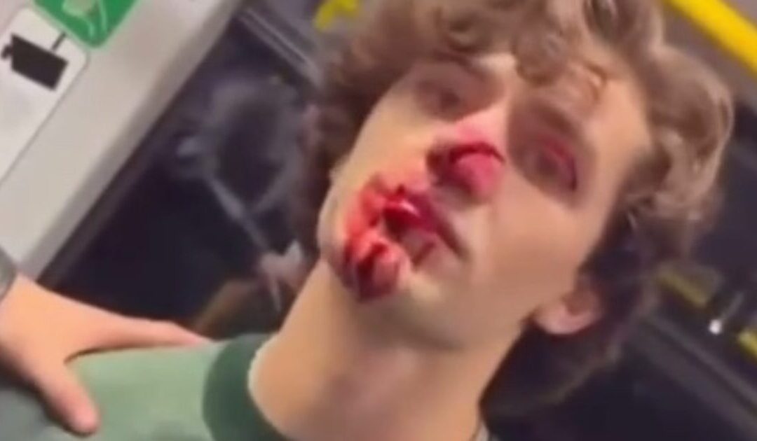 Germany Fallen: 21-Year-Old AMERICAN HERO Speaks Out After Standing Up to Rapey Migrants and Getting NOSE SLASHED