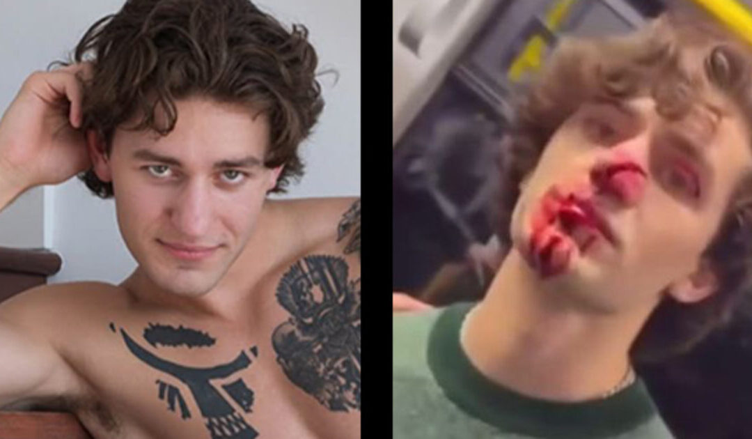 AMERICAN HERO John Rudat Slashed in Face Defending 2 Women in Germany – “My Modeling Career Is Over – But I Would Do It Again!”