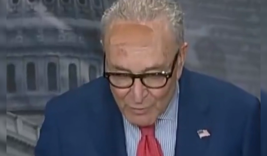 Senator Chuck Schumer Attends Press Conference With Giant Bandage on Forehead — Claims He Ran Into Door