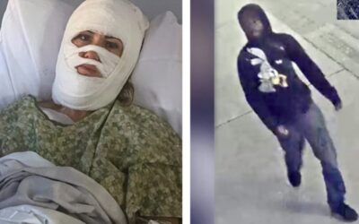 Georgia Acid Attack Victim Lashes Out at Savannah Mayor and Police For Withholding Video Evidence, Suggesting She Personally Knew Suspect