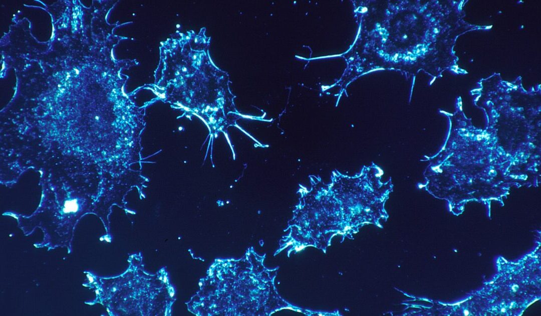 ‘Unusual Cluster’ of Rare Child Cancer Cases Triggers Calls for Investigation