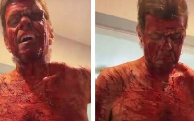 Celebrity Blogger Perez Hilton Still Hospitalized After Cutting Himself on TikTok Live, Will Need Surgery