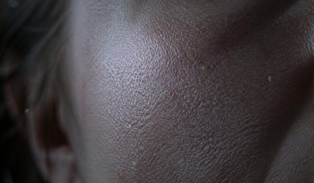 Crazy As It Sounds, There Are Probably Microscopic Mites In Your Face Pores That Come Out At Night