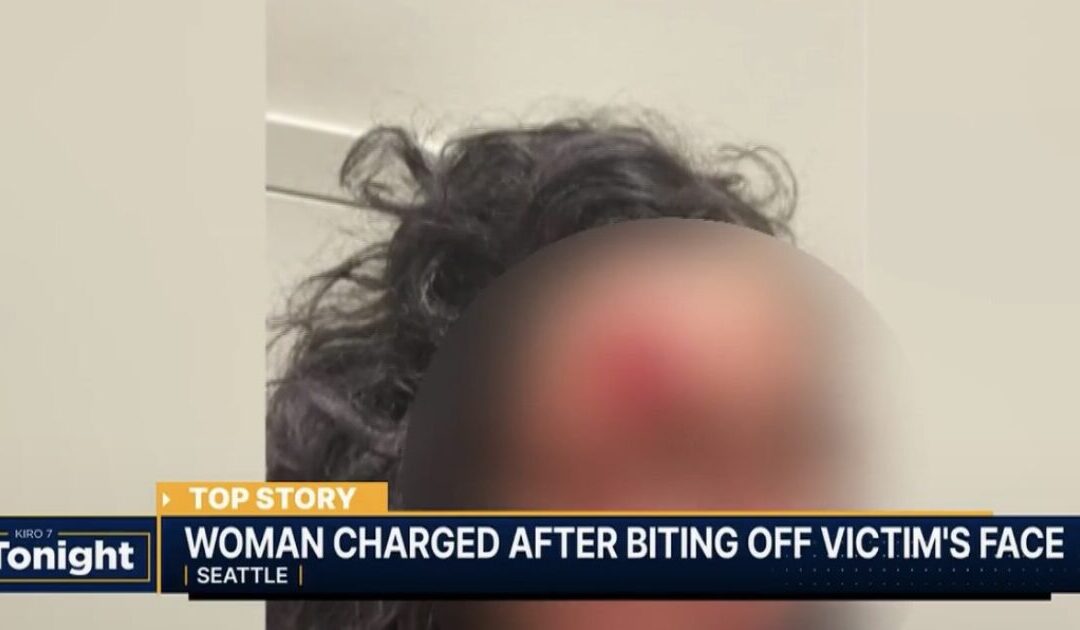 HORROR: ‘Zombie’ Attacker Bites Chunk of Woman’s Face Off in Seattle in Racially Motivated Attack