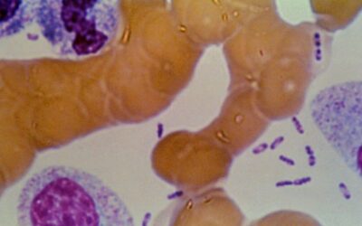 Possible Plague Crisis in Siberia: Five Hospitals Placed Under Quarantine After Lab Tech Dies Following Test Tube Accident Containing Plague Bacteria
