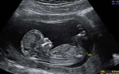 ‘I don’t care if abortion is murder’: Promoters Abandon Moderation