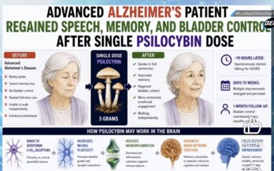 SHOCK CASE REPORT: Advanced Alzheimer’s Patient Regains Speech, Memory, Mobility, and Bladder Control After a Single High Dose of Psilocybin-Containing Mushrooms